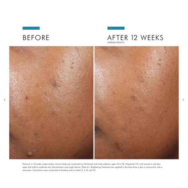 Phyto A+ Brightening Treatment