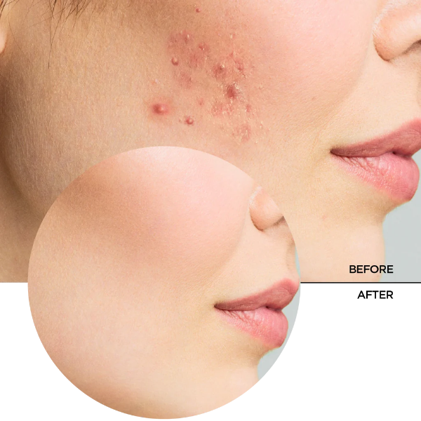 Zitcare AHA BHA PHA Active Face Toner