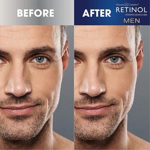 Men Moisturizer