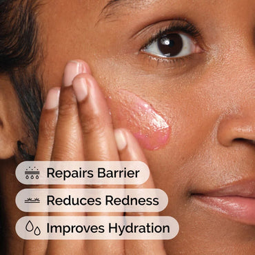 Soothing & Barrier Support Serum 30Ml/1Floz