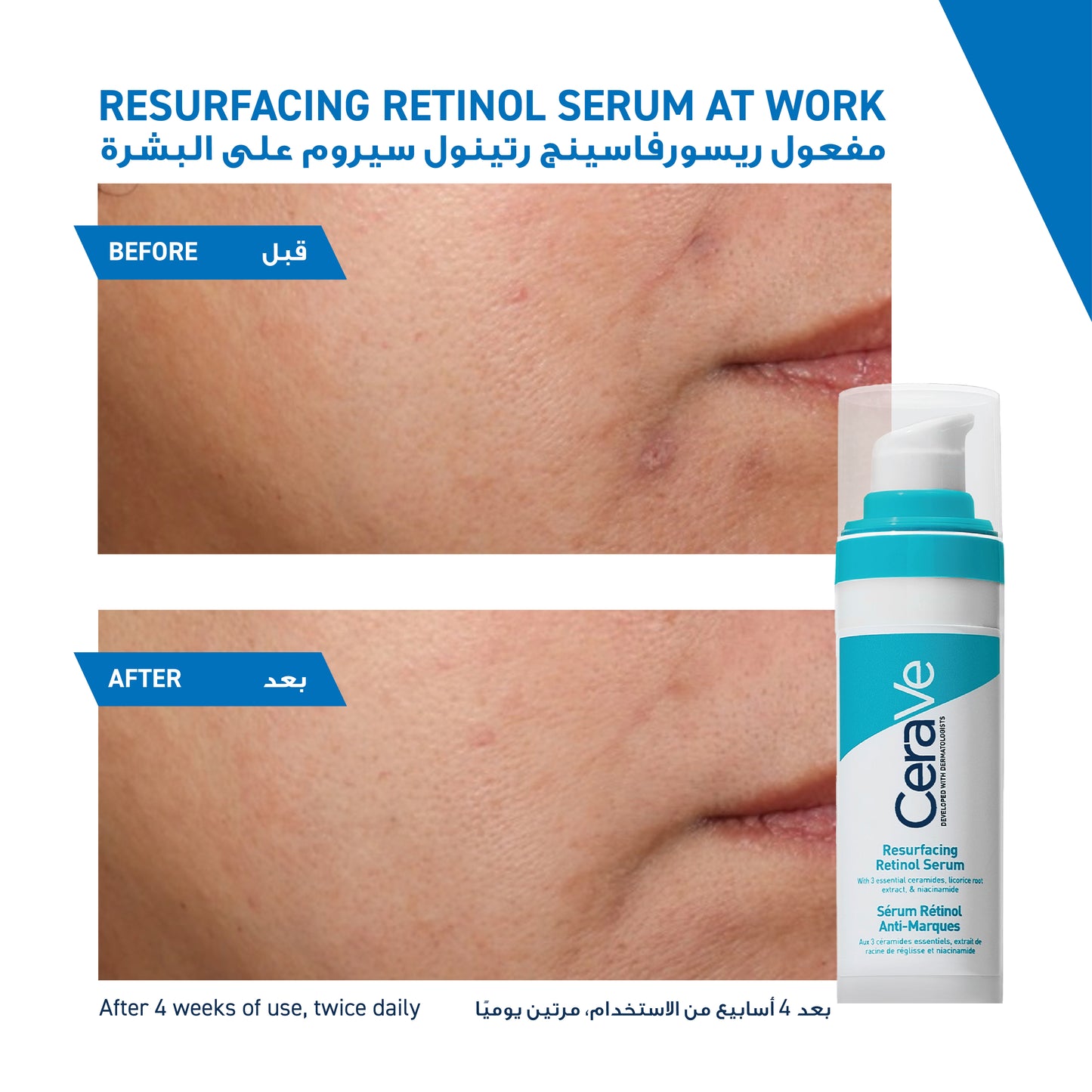 Resurfacing Retinol Serum 30mL