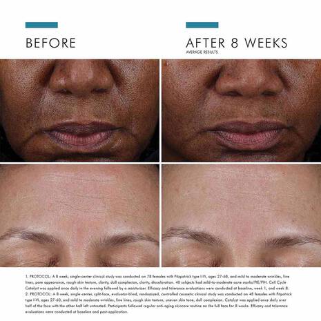 Cell Cycle Catalyst Skin Surface Renewal Accelerator to Exfoliate 30 ML