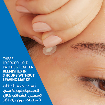 Blemish Barrier Patches With 3 Essential Ceramides and Niacinamide, 22pcs