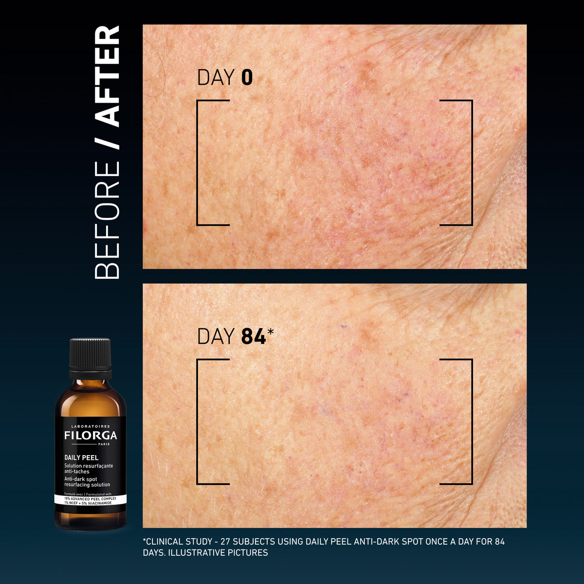 Filorga Daily Peel Anti-Dark Spot Resurfacing Solution 50ml