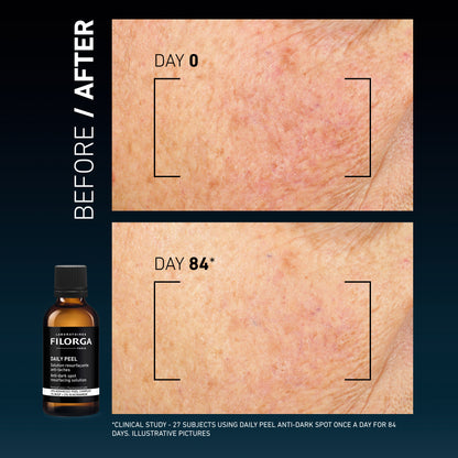 Filorga Daily Peel Anti-Dark Spot Resurfacing Solution 50ml