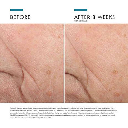 Triple Lipid Restore 2:4:2