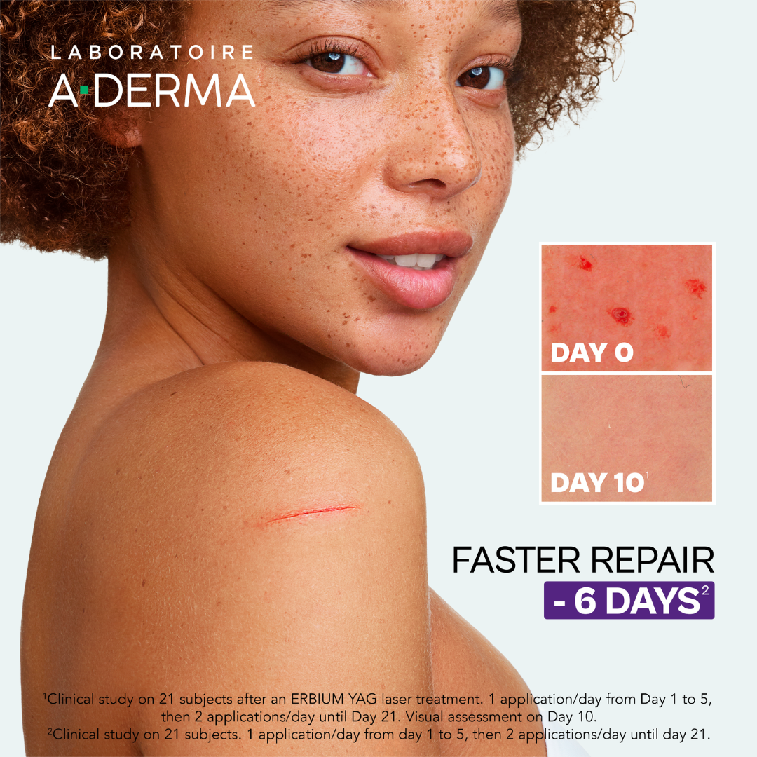 Buy one A-Derma Epitheliale AH Ultra Anti-mark Repairing Cream and get a FREE 50ml A-Derma hand and nails cream