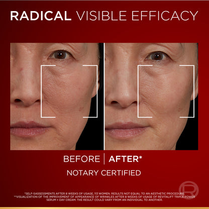 Revitalift Laser Triple Power Serum 30 ML
