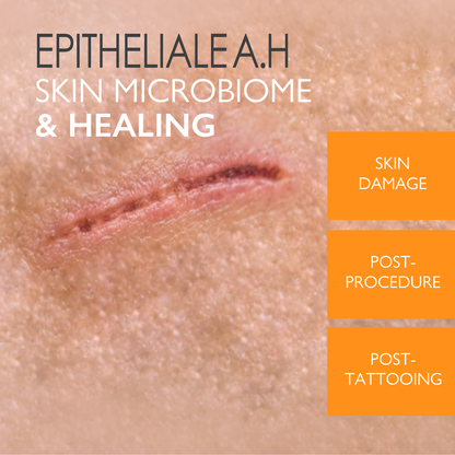 Buy One Get One A-Derma Epitheliale AH Ultra Anti-mark Ultra Repairing cream 2x40ml