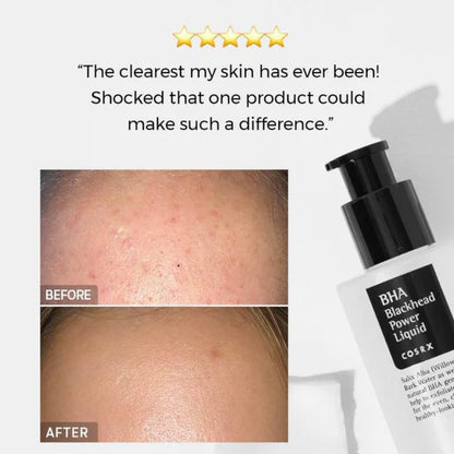 BHA Blackhead Power Liquid