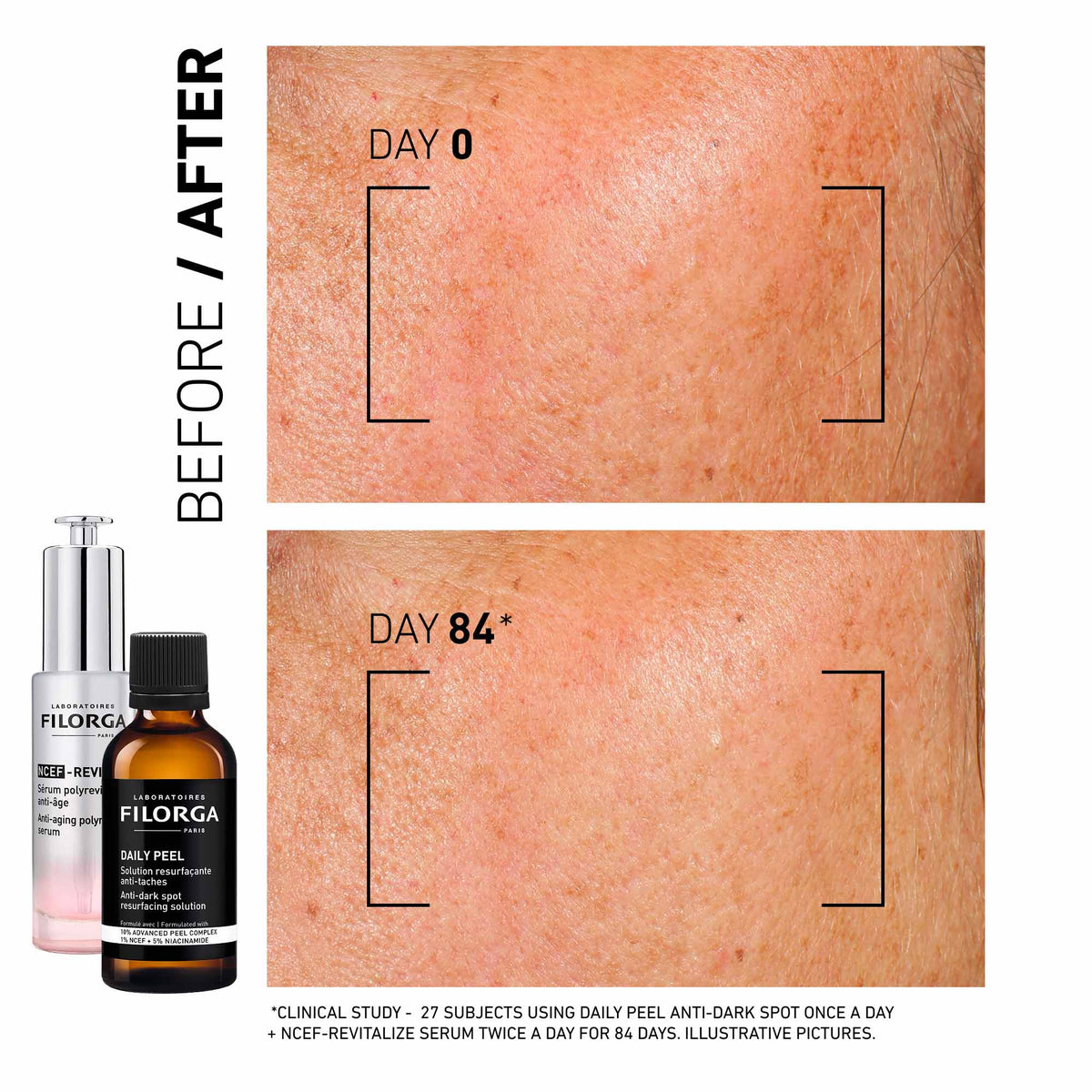 Filorga Daily Peel Anti-Dark Spot Resurfacing Solution 50ml