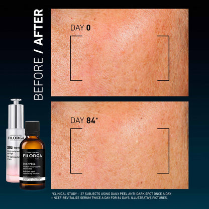 Filorga Daily Peel Anti-Dark Spot Resurfacing Solution 50ml