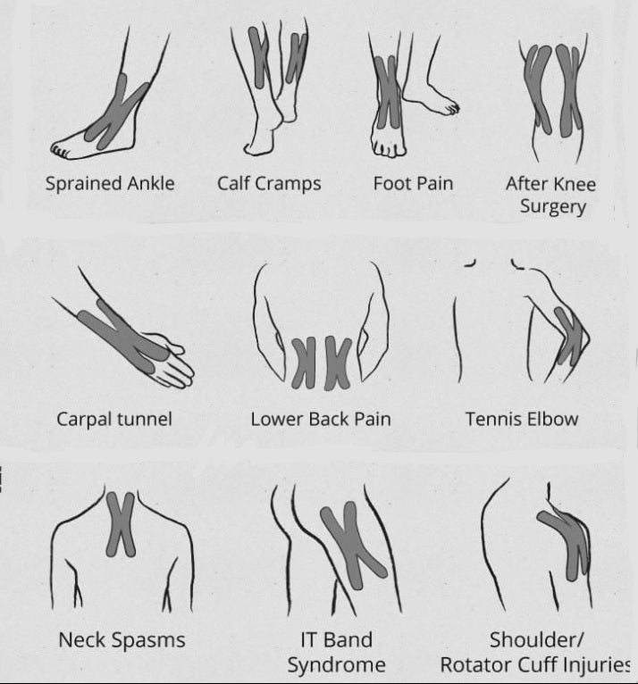 Athletic Sports Tape