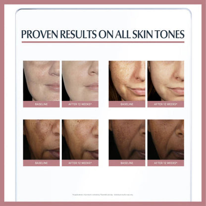 Even Pigment Perfector Dual Serum 30 ML