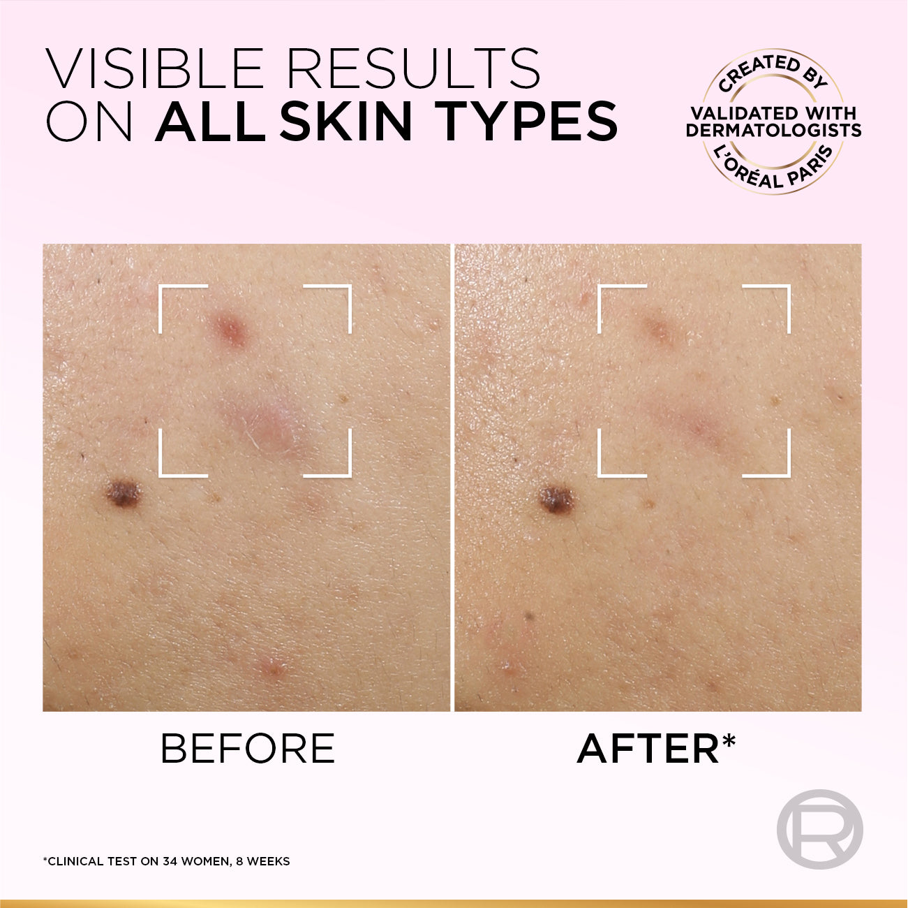Glycolic Bright Anti-Dark Spot Exfoliant Peel 25 ML