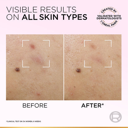 Glycolic Bright Anti-Dark Spot Exfoliant Peel 25 ML