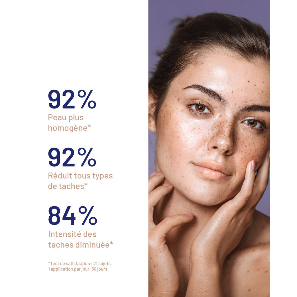 SOSKIN Meladerm Dark Spot Brightening Serum efficacy