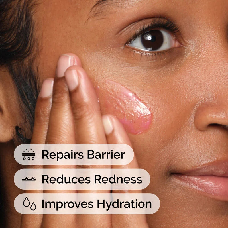 Soothing & Barrier Support Serum 30Ml/1Floz