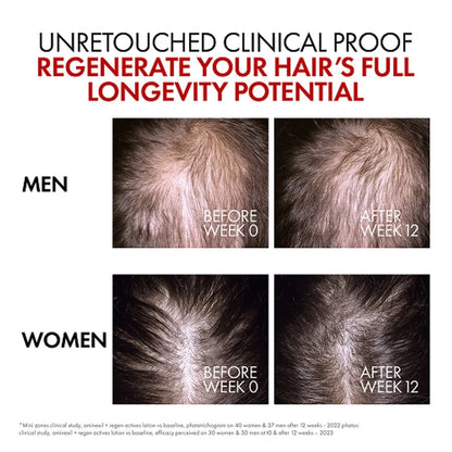 Dercos Aminexil Clinical R.E.G.E.N. Booster 90mL
